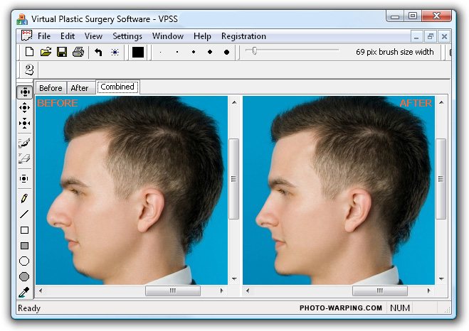 Virtual.Plastic.Surgery.Software.1.0.0.1484 ( 2010 )